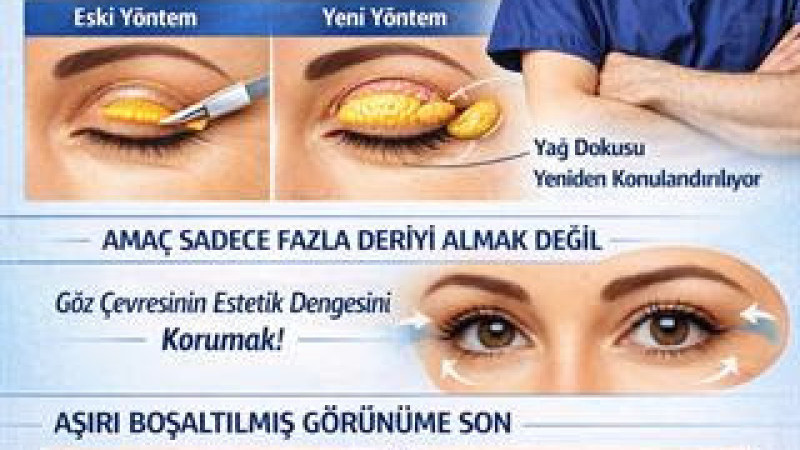 GÖZ KAPAĞI ESTETİĞİNDE YENİ DÖNEM:
